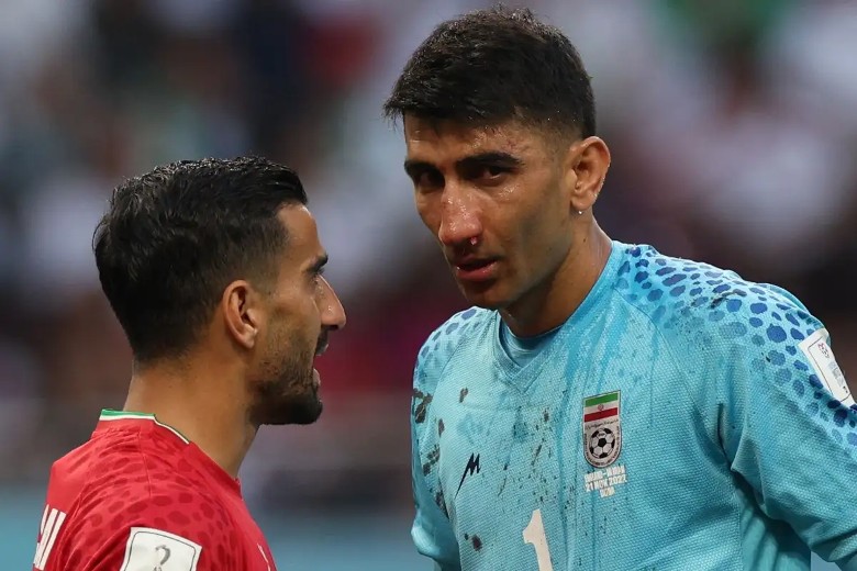 Thủ môn số 1 Iran chấn thương vỡ mũi, nghỉ thi đấu hết World Cup 2022 - Ảnh 2