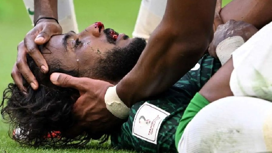 Hậu vệ Saudi Arabia phải phẫu thuật xương hàm lần hai sau chấn thương kinh hoàng